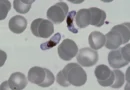 Parasita da malária usa melatonina, o hormônio do sono, para se desenvolver